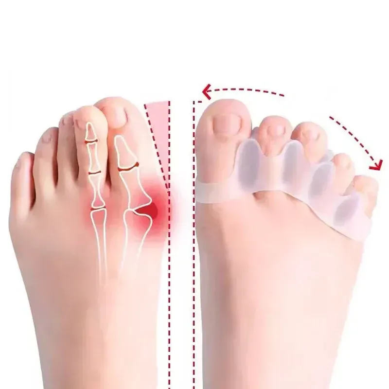 Medical Toe Separator Silicone Bunion Corrector For Pain Relief - Product showcase